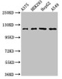 Western Blot; Positive WB detected in: A375 whole cell lysate, HEK293 whole cell lysate, HepG2 whole cell lysate, A549 whole cell lysate; All lanes: FARP1 antibody at 3µg/ml; Secondary; Goat polyclonal to rabbit IgG at 1/50000 dilution; Predicted band size: 119, 123, 15 kDa; Observed band size: 119 kDa; Western Blot; Positive WB detected in: A375 whole cell lysate, HEK293 whole cell lysate, HepG2 whole cell lysate, A549 whole cell lysate; All lanes: FARP1 antibody at 3µg/ml; Secondary; Goat polyclonal to rabbit IgG at 1/50000 dilution; Predicted band size: 119, 123, 15 kDa; Observed band size: 119 kDa;