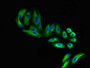 Immunofluorescent analysis of HepG2 cells using CAC09992 at dilution of 1:100 and Alexa Fluor 488-congugated AffiniPure Goat Anti-Rabbit IgG(H+L) Immunofluorescent analysis of HepG2 cells using CAC09992 at dilution of 1:100 and Alexa Fluor 488-congugated AffiniPure Goat Anti-Rabbit IgG(H+L)