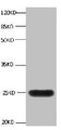All lanes:Mouse anti-human Neutrophil gelatinase-associated lipocalin monoclonal antibody at 1ug/ml; Lane 1:NGAL transfected 293 cell lysate; Predicted band size : 22 kDa; Observed band size : 25 kDa;