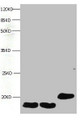 All lanes: Mouse anti- Human Fatty acid-binding protein monoclonal antibody at 1ug/ml; , Lane 1:mouse heart muscle lysate; , Lane 2:rat heart muscle lysate; , Lane 3:FABP3 transfected SF9 cell lysate; , Predicted band size : 15kd; , Observed band size : 15kd;