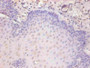 Immunohistochemical of paraffin-embedded human esophageal tissue using CAC10264 at dilution of 1:200