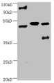 All lanes:Mouse anti-human ENO2 monoclonal antibody at 1ug/ml; Lane 1:Hela cell lysate; Lane 2:Recombinant Human Gamma-enolase(ENO2) at 10ug; Lane 3:U251 cell lysate; Secondary Goat polyclonal to Mouse IgG at 1/3000 dilution; Predicted band size : 43,48 kD; Observed band size: 48 kD; Additional bands at : 100kDa.
