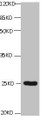 All lanes: Mouse Anti-CD59 monoclonal antibody at 1ug/ml; , Lane 1:K562; , Predicted band size : 15kd; , Observed band size : 22kd