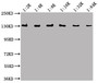 Western Blot; Positive WB detected in Recombinant protein; All lanes: lacZ antibody at 1:2000, 1:4000, 1:8000, 1:16000, 1:32000, 1:64000; Secondary; Goat polyclonal to Mouse IgG at 1/50000 dilution; Predicted band size: 117 kDa; Observed band size: 130 kDa;