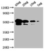 Western Blot; Positive WB detected in: SARS-CoV-2 nucleocapsid recombinant protein from E. Coli at 40ng, 20ng, 10ng, 5ng; All lanes N antibody at 1:1000; Secondary; Goat polyclonal to mouse IgG at 1/50000 dilution; Predicted band size: 48 KDa; Observed band size: 55 KDa;