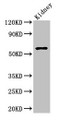 Western Blot; ,Positive WB detected in: Mouse kidney tissue; ,All lanes: Amh antibody at 2.7µg/ml; ,Secondary; ,Goat polyclonal to rabbit IgG at 1/50000 dilution; ,Predicted band size: 60 kDa; ,Observed band size: 60 kDa
