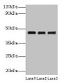 Western blot; All lanes: SERPINB14 antibody at 2µg/ml; Lane 1: Ovalbumin at 1: 4000; Lane 2: Ovalbumin at 1: 8000; Lane 3: Ovalbumin at 1: 16000; Secondary; Goat polyclonal to rabbit IgG at 1/10000 dilution; Predicted band size: 46 kDa; Observed band size: 46 kDa