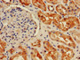 IHC image diluted at 1:800 and staining in paraffin-embedded human kidney tissue performed on a Leica BondTM system. After dewaxing and hydration, antigen retrieval was mediated by high pressure in a citrate buffer (pH 6.0). Section was blocked with 10% normal goat serum 30min at RT. Then primary antibody (1% BSA) was incubated at 4°C overnight. The primary is detected by a biotinylated secondary antibody and visualized using an HRP conjugated SP system.
