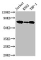 Western Blot; Positive WB detected in: Jurkat whole cell lysate, K562 whole cell lysate, THP-1 whole cell lysate; All lanes: LCP1 antibody at 2.6µg/ml; Secondary; Goat polyclonal to rabbit IgG at 1/50000 dilution; Predicted band size: 71, 22 kDa; Observed band size: 71 kDa