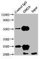 Immunoprecipitating GM2A in HEK293 whole cell lysate; , Lane 1: Rabbit control IgG instead in HEK293 whole cell lysate. For western blotting, a HRP-conjugated Protein G antibody was used as the secondary antibody (1/2000); , Lane 2: CAC10387 (8µg) + HEK293 whole cell lysate (500µg); , Lane 3: HEK293 whole cell lysate (10µg) Immunoprecipitating GM2A in HEK293 whole cell lysate; , Lane 1: Rabbit control IgG instead in HEK293 whole cell lysate. For western blotting, a HRP-conjugated Protein G antibody was used as the secondary antibody (1/2000); , Lane 2: CAC10387 (8µg) + HEK293 whole cell lysate (500µg); , Lane 3: HEK293 whole cell lysate (10µg)