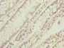 Immunohistochemistry of paraffin-embedded human colon cancer using CAC10391 at dilution of 1:100