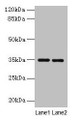Western blot; All lanes: Thpo antibody at 4µg/ml; Lane 1: Mouse liver tissue; Lane 2: 293T whole cell lysate; Secondary; Goat polyclonal to rabbit IgG at 1/10000 dilution; Predicted band size: 35 kDa; Observed band size: 35 kDa