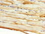IHC image diluted at 1:500 and staining in paraffin-embedded human skeletal muscle tissue performed on a Leica BondTM system. After dewaxing and hydration, antigen retrieval was mediated by high pressure in a citrate buffer (pH 6.0). Section was blocked with 10% normal goat serum 30min at RT. Then primary antibody (1% BSA) was incubated at 4°C overnight. The primary is detected by a biotinylated secondary antibody and visualized using an HRP conjugated SP system.