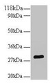 Western blot; All lanes: Bdnf antibody at 2µg/ml + U251 whole cell lysate; Secondary; Goat polyclonal to rabbit IgG at 1/10000 dilution; Predicted band size: 29 kDa; Observed band size: 29 kDa