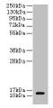 Western blot; All lanes: clpS antibody at 2µg/ml + DH5a whole cell lysate; Secondary; Goat polyclonal to rabbit IgG at 1/10000 dilution; Predicted band size: 13 kDa; Observed band size: 13 kDa Western blot; All lanes: clpS antibody at 2µg/ml + DH5a whole cell lysate; Secondary; Goat polyclonal to rabbit IgG at 1/10000 dilution; Predicted band size: 13 kDa; Observed band size: 13 kDa
