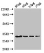 Western Blot; Positive WB detected in: Rosseta bacteria lysate at 80µg, 40µg, 20µg, 10µg; All lanes: eutC antibody at 3µg/ml; Secondary; Goat polyclonal to rabbit IgG at 1/50000 dilution; predicted band size: 32 kDa; observed band size: 32 kDa; Western Blot; Positive WB detected in: Rosseta bacteria lysate at 80µg, 40µg, 20µg, 10µg; All lanes: eutC antibody at 3µg/ml; Secondary; Goat polyclonal to rabbit IgG at 1/50000 dilution; predicted band size: 32 kDa; observed band size: 32 kDa;