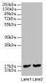 Western blot; All lanes: mpt63 antibody at 2µg/ml; Lane 1: Recombinant Mycobacterium tuberculosis Immunogenic protein MPT63 protein 1µg; Lane 2: Recombinant Mycobacterium tuberculosis Immunogenic protein MPT63 protein 0.1µg; Secondary; Goat polyclonal to rabbit IgG at 1/10000 dilution; Predicted band size: 17 kDa; Observed band size: 17 kDa