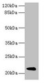 Western blot; All lanes: Mup11 antibody at 2µg/ml + Mouse liver tissue; Secondary; Goat polyclonal to rabbit IgG at 1/10000 dilution; Predicted band size: 21 kDa; Observed band size: 21 kDa
