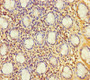 Immunohistochemistry of paraffin-embedded human colontissue using CAC10461 at dilution of 1:100 Immunohistochemistry of paraffin-embedded human colontissue using CAC10461 at dilution of 1:100
