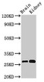 Western Blot; Positive WB detected in: Mouse brain tissue, Mouse kidney tissue; All lanes: OLFML2B antibody at 3µg/ml; Secondary; Goat polyclonal to rabbit IgG at 1/50000 dilution; Predicted band size: 84, 28 kDa; Observed band size: 28 kDa