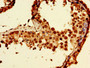 Immunohistochemistry of paraffin-embedded human testis tissue using CAC10466 at dilution of 1:100