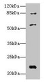 Western blot; All lanes: PYHIN1 antibody at 6µg/ml + Mouse small intestine tissue; Secondary; Goat polyclonal to rabbit IgG at 1/10000 dilution; Predicted band size: 56, 55, 52, 51, 27, 26 kDa; Observed band size: 56, 22, 84 kDa