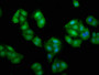 Immunofluorescence staining of HepG2 cells with CAC10478 at 1:135, counter-stained with DAPI. The cells were fixed in 4% formaldehyde, permeabilized using 0.2% Triton X-100 and blocked in 10% normal Goat Serum. The cells were then incubated with the antibody overnight at 4°C. The secondary antibody was Alexa Fluor 488-congugated AffiniPure Goat Anti-Rabbit IgG(H+L). Immunofluorescence staining of HepG2 cells with CAC10478 at 1:135, counter-stained with DAPI. The cells were fixed in 4% formaldehyde, permeabilized using 0.2% Triton X-100 and blocked in 10% normal Goat Serum. The cells were then incubated with the antibody overnight at 4°C. The secondary antibody was Alexa Fluor 488-congugated AffiniPure Goat Anti-Rabbit IgG(H+L).