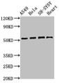 Western Blot; Positive WB detected in: A549 whole cell lysate, Hela whole cell lysate, SH-SY5Y whole cell lysate, Mouse heart tissue; All lanes: ATG4D antibody at 2.8µg/ml; Secondary; Goat polyclonal to rabbit IgG at 1/50000 dilution; Predicted band size: 53, 17 kDa; Observed band size: 53 kDa