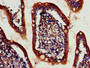 IHC image diluted at 1:700 and staining in paraffin-embedded human small intestine tissue performed on a Leica BondTM system. After dewaxing and hydration, antigen retrieval was mediated by high pressure in a citrate buffer (pH 6.0). Section was blocked with 10% normal goat serum 30min at RT. Then primary antibody (1% BSA) was incubated at 4°C overnight. The primary is detected by a biotinylated secondary antibody and visualized using an HRP conjugated SP system.