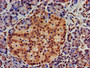 IHC image diluted at 1:700 and staining in paraffin-embedded human pancreatic tissue performed on a Leica BondTM system. After dewaxing and hydration, antigen retrieval was mediated by high pressure in a citrate buffer (pH 6.0). Section was blocked with 10% normal goat serum 30min at RT. Then primary antibody (1% BSA) was incubated at 4°C overnight. The primary is detected by a biotinylated secondary antibody and visualized using an HRP conjugated SP system.