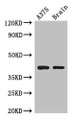 Western Blot; Positive WB detected in: A375 whole cell lysate, Mouse brain tissue; All lanes: SEPT12 antibody at 3.5µg/ml; Secondary; Goat polyclonal to rabbit IgG at 1/50000 dilution; Predicted band size: 41, 36 kDa; Observed band size: 41 kDa Western Blot; Positive WB detected in: A375 whole cell lysate, Mouse brain tissue; All lanes: SEPT12 antibody at 3.5µg/ml; Secondary; Goat polyclonal to rabbit IgG at 1/50000 dilution; Predicted band size: 41, 36 kDa; Observed band size: 41 kDa