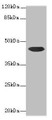 Western blot; All lanes: CCDC89 antibody at 1.7µg/ml + Mouse kidney tissue; Secondary; Goat polyclonal to rabbit IgG at 1/10000 dilution; Predicted band size: 44 kDa; Observed band size: 44 kDa