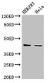 Western Blot; ,Positive WB detected in: HEK293 whole cell lysate, Hela whole cell lysate; ,All lanes: LPGAT1 antibody at 3µg/ml; ,Secondary; ,Goat polyclonal to rabbit IgG at 1/50000 dilution; ,Predicted band size: 44 kDa; ,Observed band size: 44 kDa