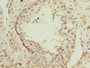Immunohistochemistry of paraffin-embedded human testis tissue using CAC10495 at dilution of 1:100