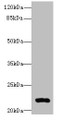 Western blot; All lanes: ARL14 antibody at 0.3µg/ml + MCF-7 whole cell lysate; Secondary; Goat polyclonal to rabbit IgG at 1/10000 dilution; Predicted band size: 22 kDa; Observed band size: 22 kDa