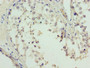 Immunohistochemistry of paraffin-embedded human testis tissue using CAC10502 at dilution of 1:100 Immunohistochemistry of paraffin-embedded human testis tissue using CAC10502 at dilution of 1:100