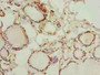 Immunohistochemistry of paraffin-embedded human thyroid tissue using CAC10505 at dilution of 1:100