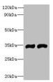 Western blot; All lanes: FYTTD1 antibody at 4µg/ml; Lane 1: A375 whole cell lysate; Lane 2: Jurkat whole cell lysate; Secondary; Goat polyclonal to rabbit IgG at 1/10000 dilution; Predicted band size: 36, 34, 29, 15 kDa; Observed band size: 36 kDa Western blot; All lanes: FYTTD1 antibody at 4µg/ml; Lane 1: A375 whole cell lysate; Lane 2: Jurkat whole cell lysate; Secondary; Goat polyclonal to rabbit IgG at 1/10000 dilution; Predicted band size: 36, 34, 29, 15 kDa; Observed band size: 36 kDa