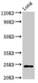Western Blot; , Positive WB detected in: Rat lung tissue; , All lanes: CHMP6 antibody at 3µg/ml; , Secondary; , Goat polyclonal to rabbit IgG at 1/50000 dilution; , Predicted band size: 24 kDa; , Observed band size: 24 kDa Western Blot; , Positive WB detected in: Rat lung tissue; , All lanes: CHMP6 antibody at 3µg/ml; , Secondary; , Goat polyclonal to rabbit IgG at 1/50000 dilution; , Predicted band size: 24 kDa; , Observed band size: 24 kDa