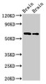 Western Blot; Positive WB detected in: Rat brain tissue, Mouse brain tissue; All lanes: CPNE4 antibody at 2µg/ml; Secondary; Goat polyclonal to rabbit IgG at 1/50000 dilution; Predicted band size: 63, 65 kDa; Observed band size: 63 kDa;