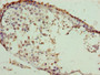 Immunohistochemistry of paraffin-embedded human testis tissue using CAC10521 at dilution of 1:100 Immunohistochemistry of paraffin-embedded human testis tissue using CAC10521 at dilution of 1:100