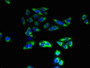 Immunofluorescent analysis of HepG2 cells using CAC10521 at dilution of 1:100 and Alexa Fluor 488-congugated AffiniPure Goat Anti-Rabbit IgG(H+L) Immunofluorescent analysis of HepG2 cells using CAC10521 at dilution of 1:100 and Alexa Fluor 488-congugated AffiniPure Goat Anti-Rabbit IgG(H+L)