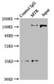 Immunoprecipitating MTR in Hela whole cell lysate; , Lane 1: Rabbit control IgG instead in Hela whole cell lysate. For western blotting, a HRP-conjugated Protein G antibody was used as the secondary antibody (1/2000); , Lane 2: CAC10527 (8µg) + Hela whole cell lysate (500µg); , Lane 3: Hela whole cell lysate (10µg)