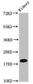 Western Blot; Positive WB detected in: Mouse kidney tissue; All lanes: NAA38 antibody at 4µg/ml; Secondary; Goat polyclonal to rabbit IgG at 1/50000 dilution; Predicted band size: 14, 19 kDa; Observed band size: 19 kDa