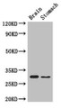 Western Blot; Positive WB detected in: Mouse brain tissue, Mouse stomach tissue; All lanes: COPS7B antibody at 3µg/ml; Secondary; Goat polyclonal to rabbit IgG at 1/50000 dilution; Predicted band size: 30, 19, 31 kDa; Observed band size: 30 kDa