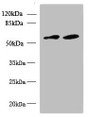 Western blot; All lanes: KBTBD4 antibody at 10µg/ml; Lane 1: U87 whole cell lysate; Lane 2: NIH/3T3 whole cell lysate; Secondary; Goat polyclonal to rabbit IgG at 1/10000 dilution; Predicted band size: 59, 60 kDa; Observed band size: 59 kDa;