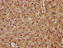 IHC image of CAC10543 diluted at 1:700 and staining in paraffin-embedded human liver tissue performed on a Leica BondTM system. After dewaxing and hydration, antigen retrieval was mediated by high pressure in a citrate buffer (pH 6.0). Section was blocked with 10% normal goat serum 30min at RT. Then primary antibody (1% BSA) was incubated at 4°C overnight. The primary is detected by a biotinylated secondary antibody and visualized using an HRP conjugated SP system.