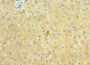 Immunohistochemistry of paraffin-embedded human liver tissue using CAC10561 at dilution of 1:100