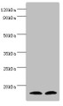 Western blot; All lanes: Protachykinin-1 antibody at 6µg/ml; Lane 1: Mouse liver tissue; Lane 2: 293T whole cell lysate; Secondary; Goat polyclonal to rabbit IgG at 1/10000 dilution; Predicted band size: 16, 14, 12 kDa; Observed band size: 16 kDa;
