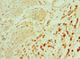 Immunohistochemistry of paraffin-embedded human epityphlon tissue using CAC10574 at dilution of 1:100